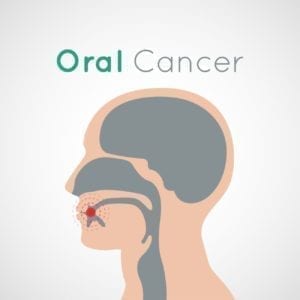 oral cancer care in Roslyn, New York