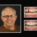 riverhead new york cosmetic dentist patient photo