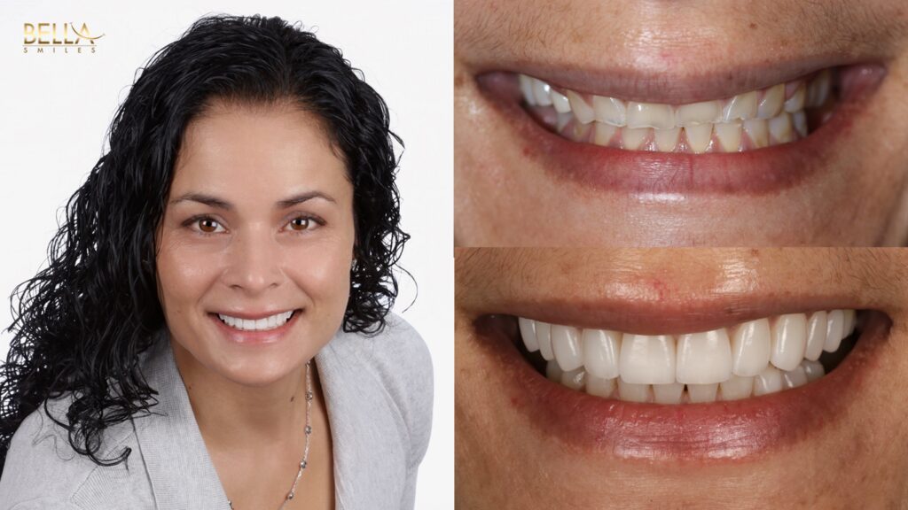 Dental patient before and after photos