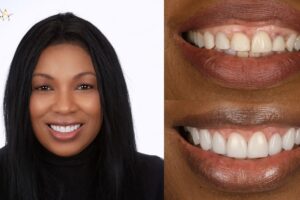 Main Gallery Image 151 | Smile Gallery