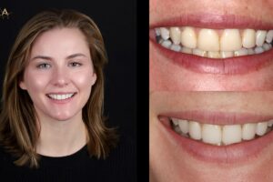 Main Gallery Image 152 | Smile Gallery