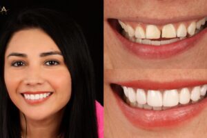 Main Gallery Image 153 | Smile Gallery