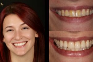Main Gallery Image 155 | Smile Gallery
